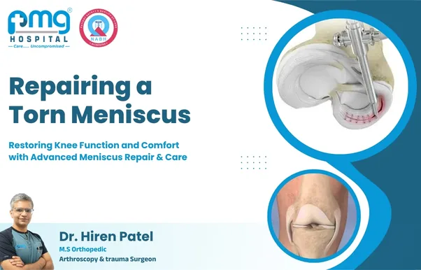 Repairing a Torn Meniscus - arthroscopic treatment by Dr. Hiren Patel at PMG Hospital, Ahmedabad
