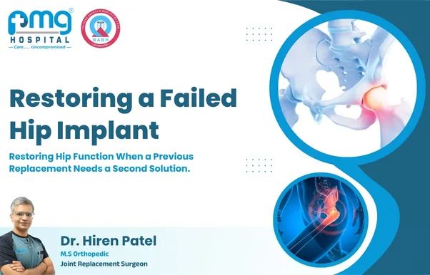 Restoring a Failed Hip Implant - joint replacement by Dr. Hiren Patel at PMG Hospital, Ahmedabad