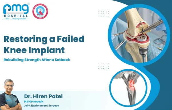 Restoring a Failed Knee Implant - joint replacement by Dr. Hiren Patel at PMG Hospital, Ahmedabad