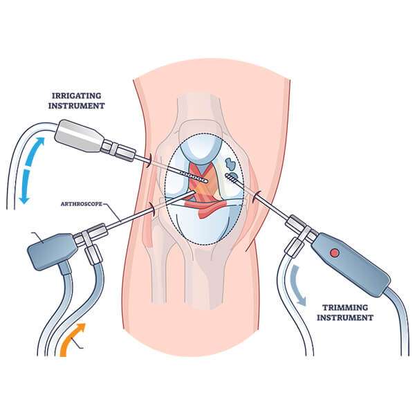 Arthroscopy Orthopedic Surgeon